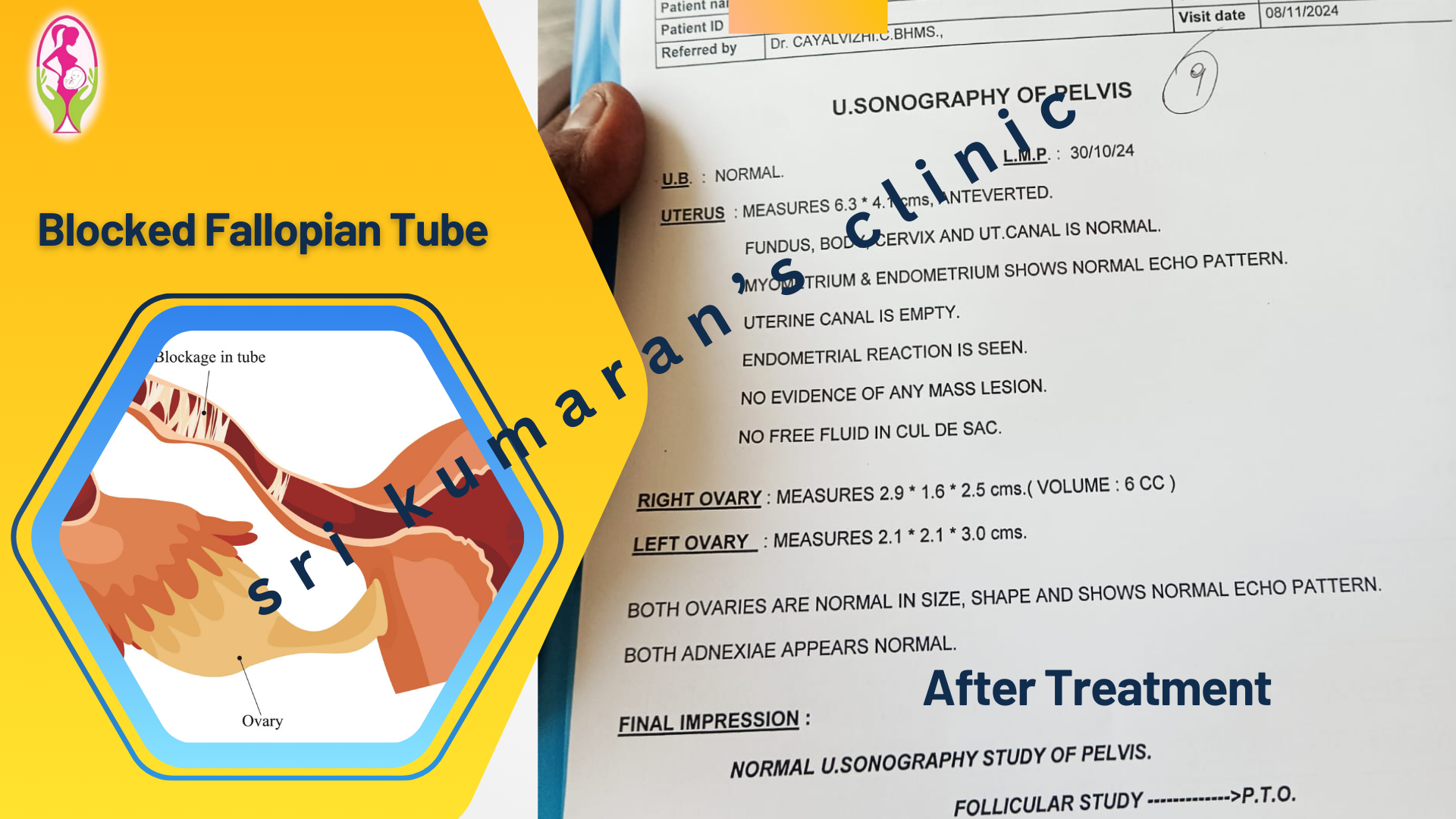 Protected Case Image